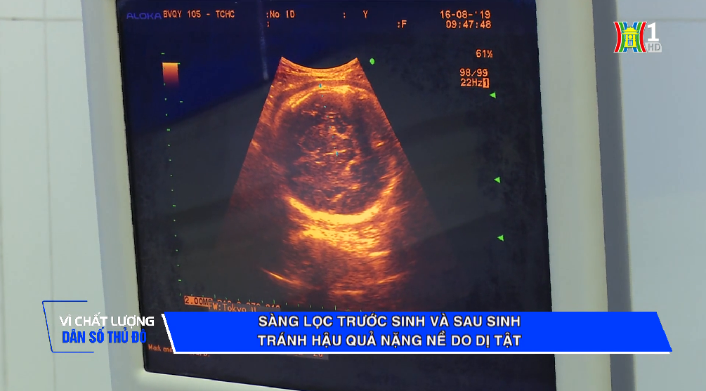 Vì chất lượng dân số Thủ đô - Sàng lọc trước sinh và sau sinh tránh những hậu quả nặng nề do dị tật